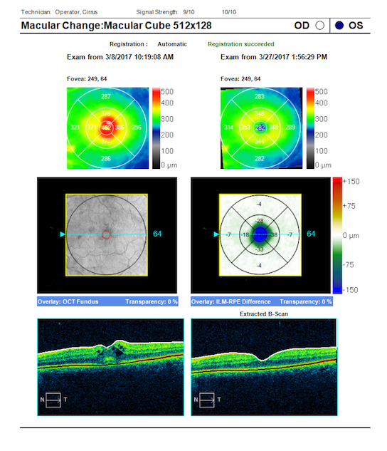 Retinal Eye Exam in Dallas, TX | Infinity Vision Dallas